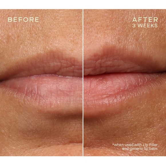 $15❤️‍🔥 LAST 1! Ourself Lip Filler Plumping 👄 NEW Hyaluronic Acid Technology - Picture 5 of 6